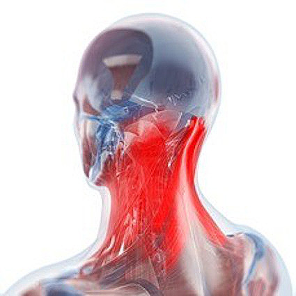 il dolore al collo si manifesta come dolore cervicale